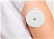 Continuous Glucose Monitors (CGM)
