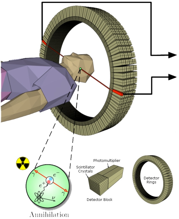 PET scan detector blocks and ring.