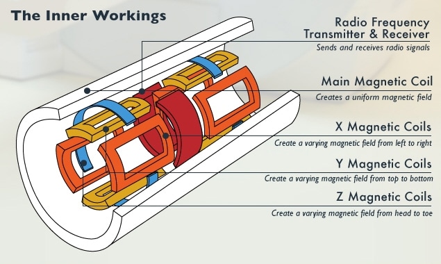 MRI transmitter, receiver, and coils.